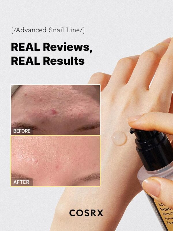 Advanced Snail 96 Mucin Power Essence - Image 7