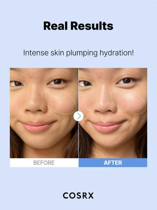 The Hyaluronic Acid 3 Serum - Image 6