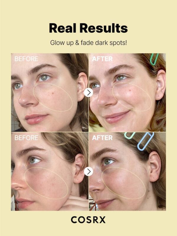 The Vitamin C 23 Serum - Image 10